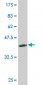 IL1A Antibody (monoclonal) (M01)